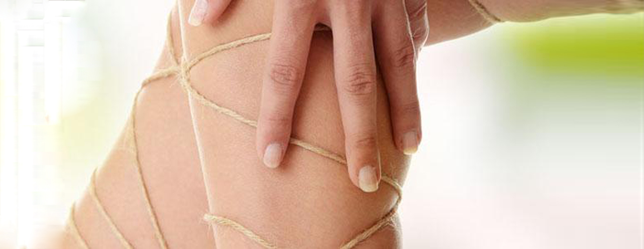 Varicose Veins SURREY VEINS